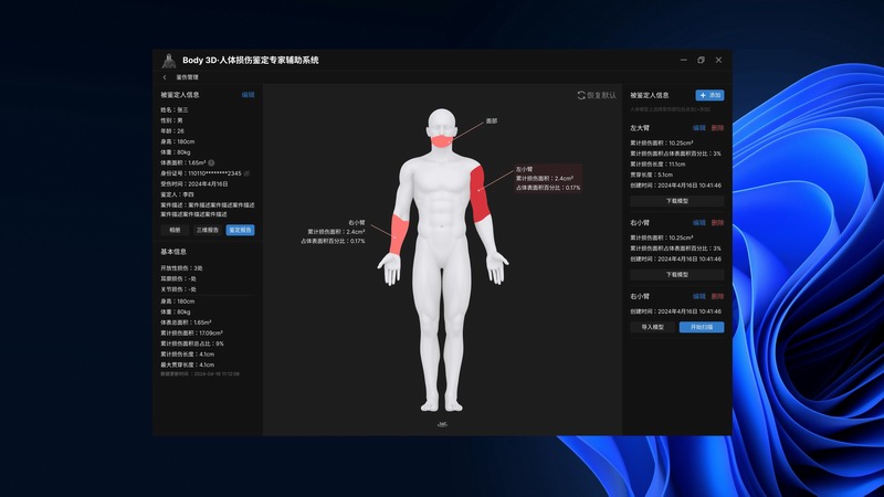 YZ-3DR   人體損傷鑒定專家輔助系統(tǒng)